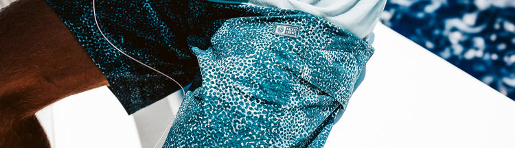 Close-up of a person wearing teal and white patterned shorts with a small logo tag, sitting outdoors in bright sunlight. The background is mostly out of focus with hints of blue and white.